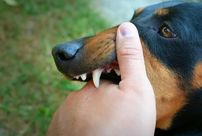Dog Bite Injuries-image